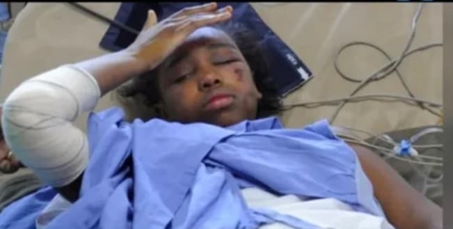 12-Year-Old Girl Found Alive After Plane Crash Kills 152 Passengers